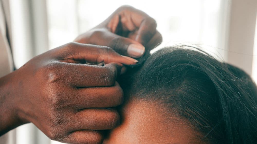 Scalp treatment application