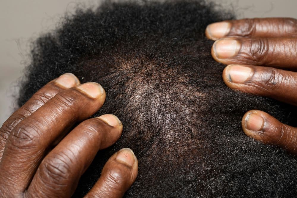 Close detail of a scalp assessment